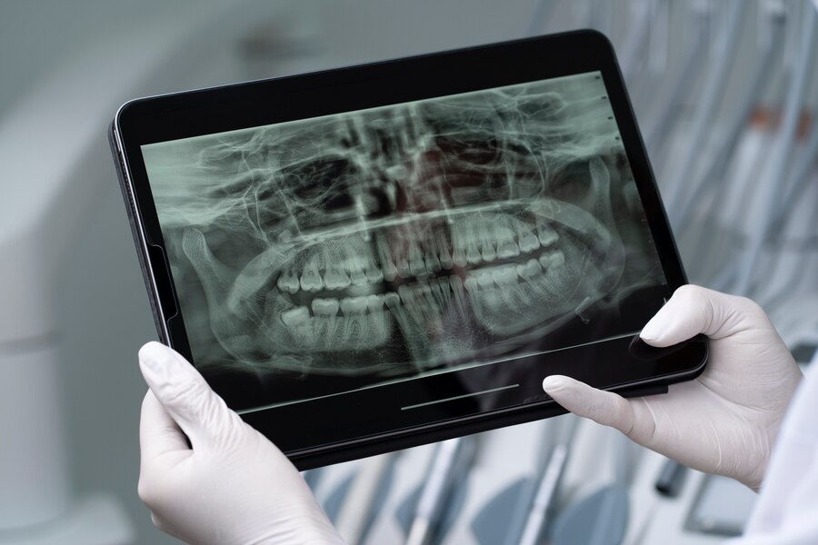 Medicul dentist explică rezultatul radiografiei dentare unui pacient la STOMESTET Cluj