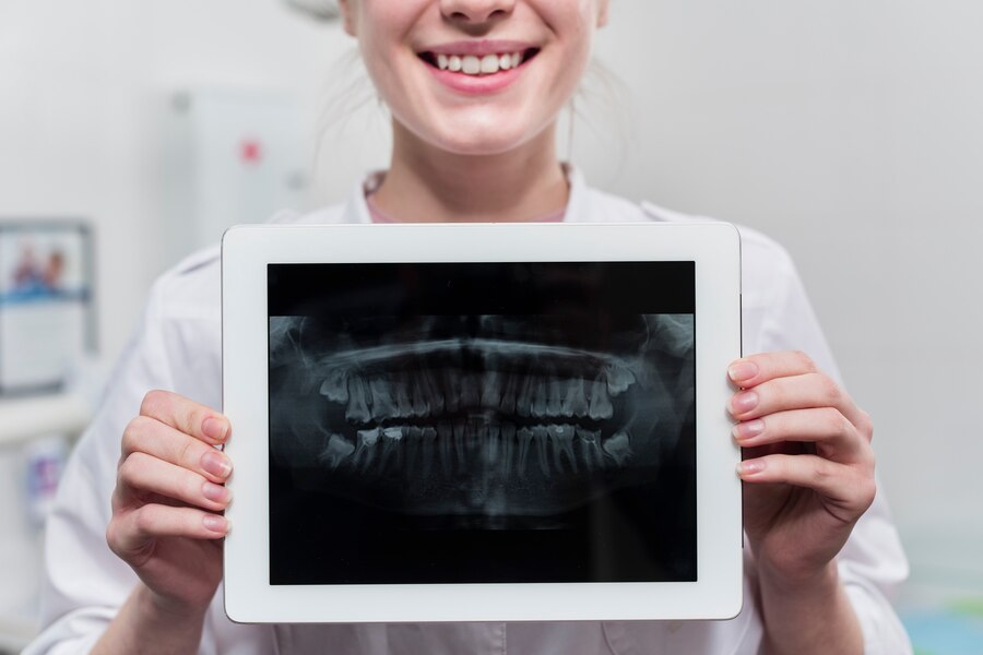 Investigație prin radiografie panoramică efectuată în clinica STOMESTET Cluj