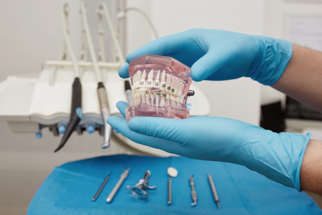 Tratament cu aparat dentar metalic pentru adulți realizat la STOMESTET Cluj
