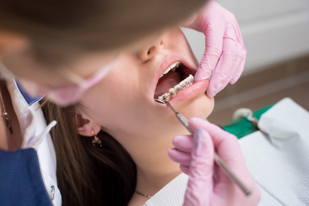 Consultație ortodontică pentru aparat dentar la adulți în cadrul STOMESTET Cluj