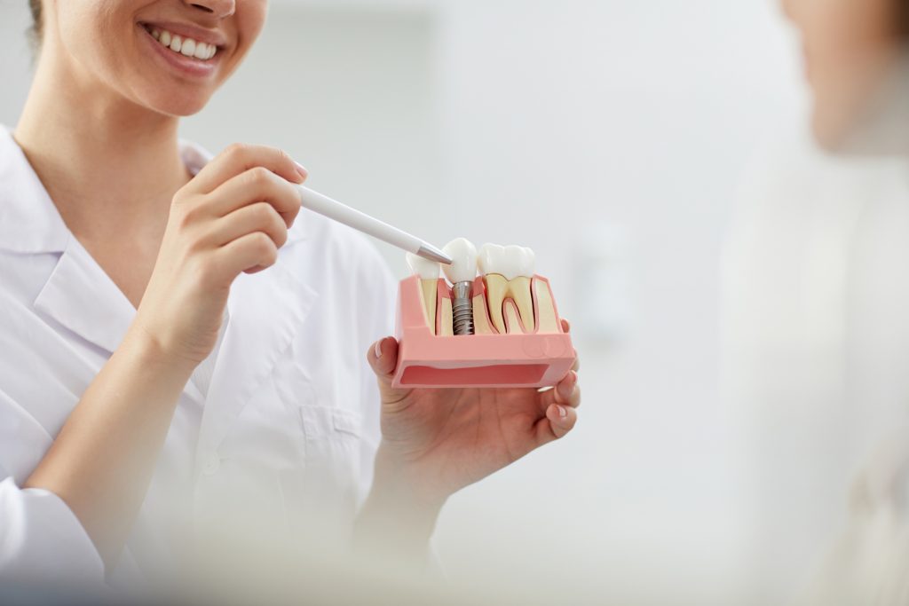 Implant dentar pentru un dinte lipsă realizat la STOMESTET Cluj