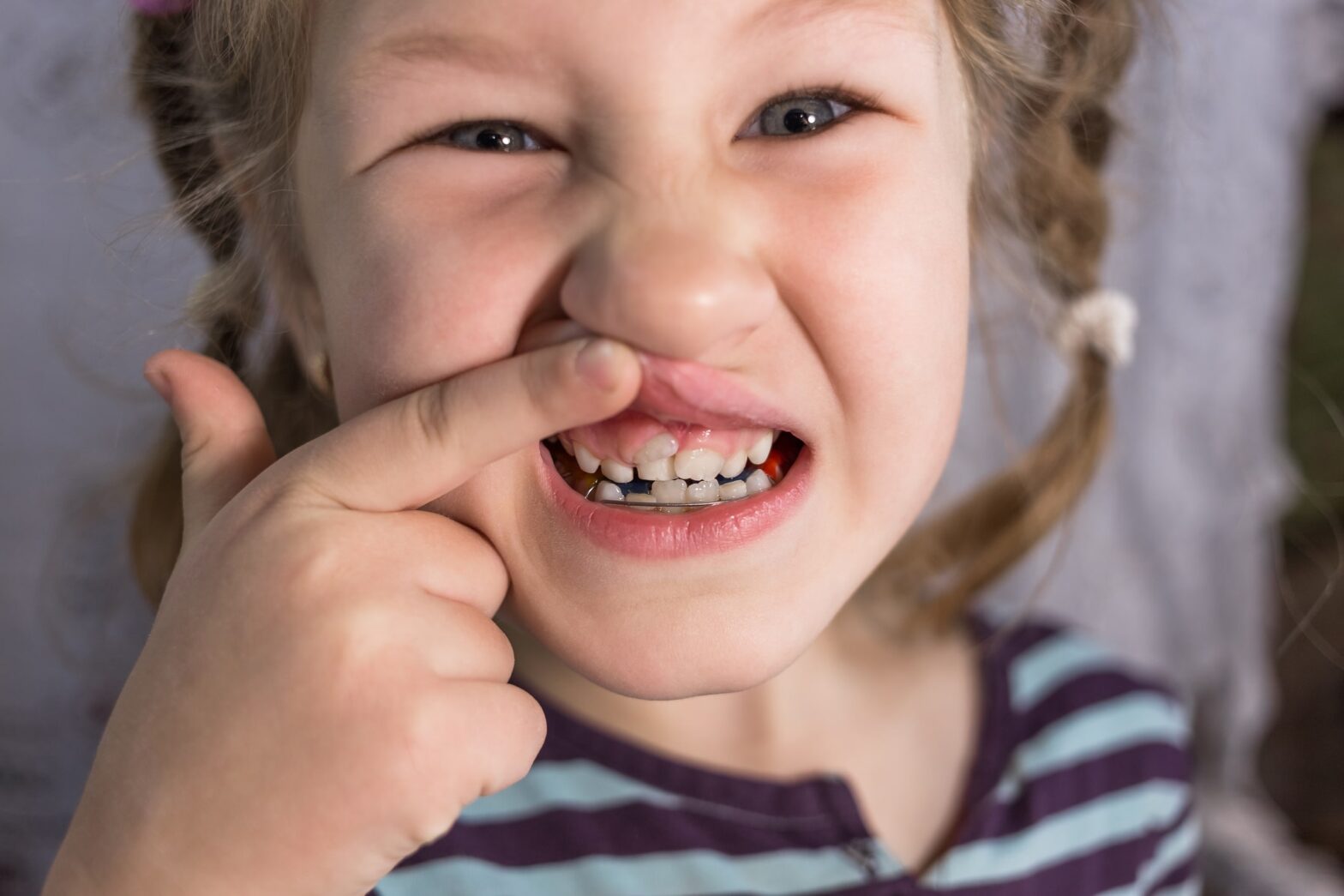 erupția dinților permanenți