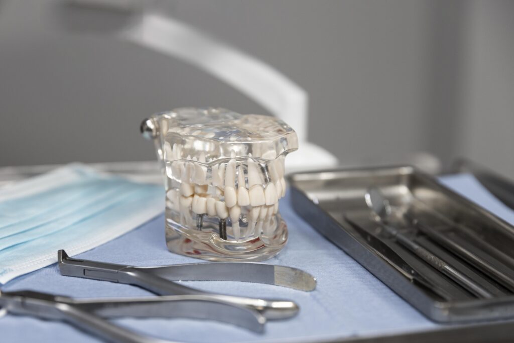 Inflamație periimplantară și pierdere osoasă la implant dentar