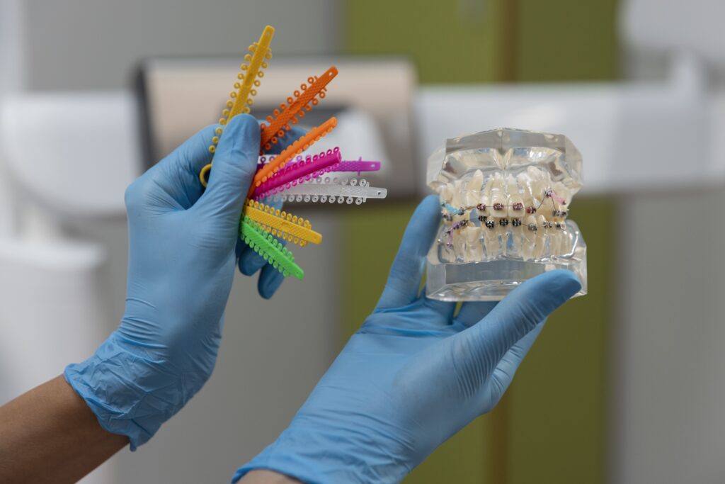 Probleme dentare care pot amâna montarea aparatului dentar