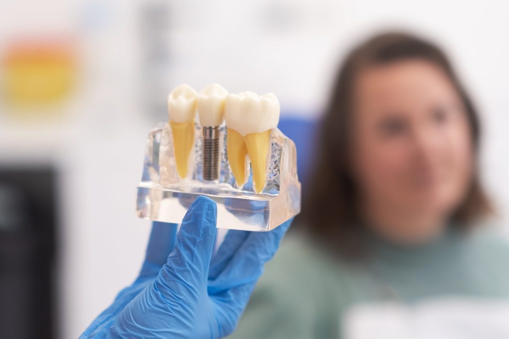 Implant dentar MEGAGEN în timpul procedurii realizate la STOMESTET Cluj