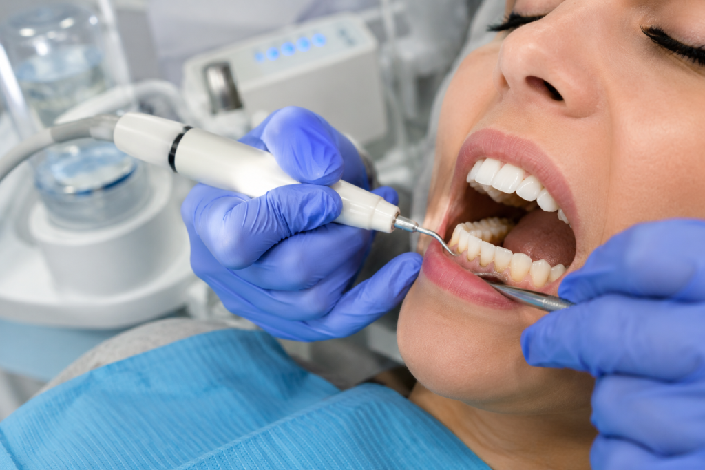 Detartraj dentar cu ultrasunete realizat la STOMESTET în Cluj