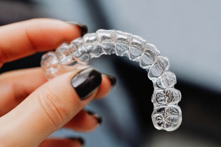 Gutieră de contenție după aparat dentar recomandată la STOMESTET Cluj