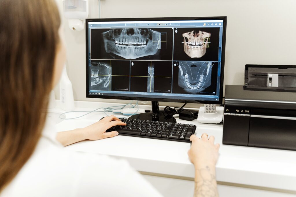 Tomografie dentară realizată înainte de replantarea dentară pentru evaluarea rădăcinii și a osului