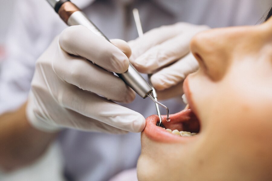 Igienizare profesională în jurul unui implant dentar în Cluj-Napoca